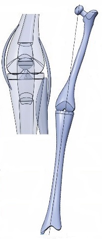Автоматизація моделювання та аналізу розрахунку фрагмента нижньої кінцівки людини